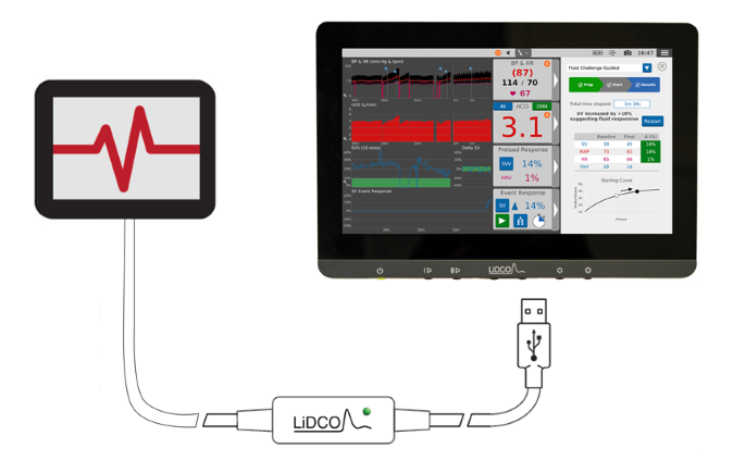 LiDCO-Monitor mit Kabel, das an das Lesegerät angeschlossen ist