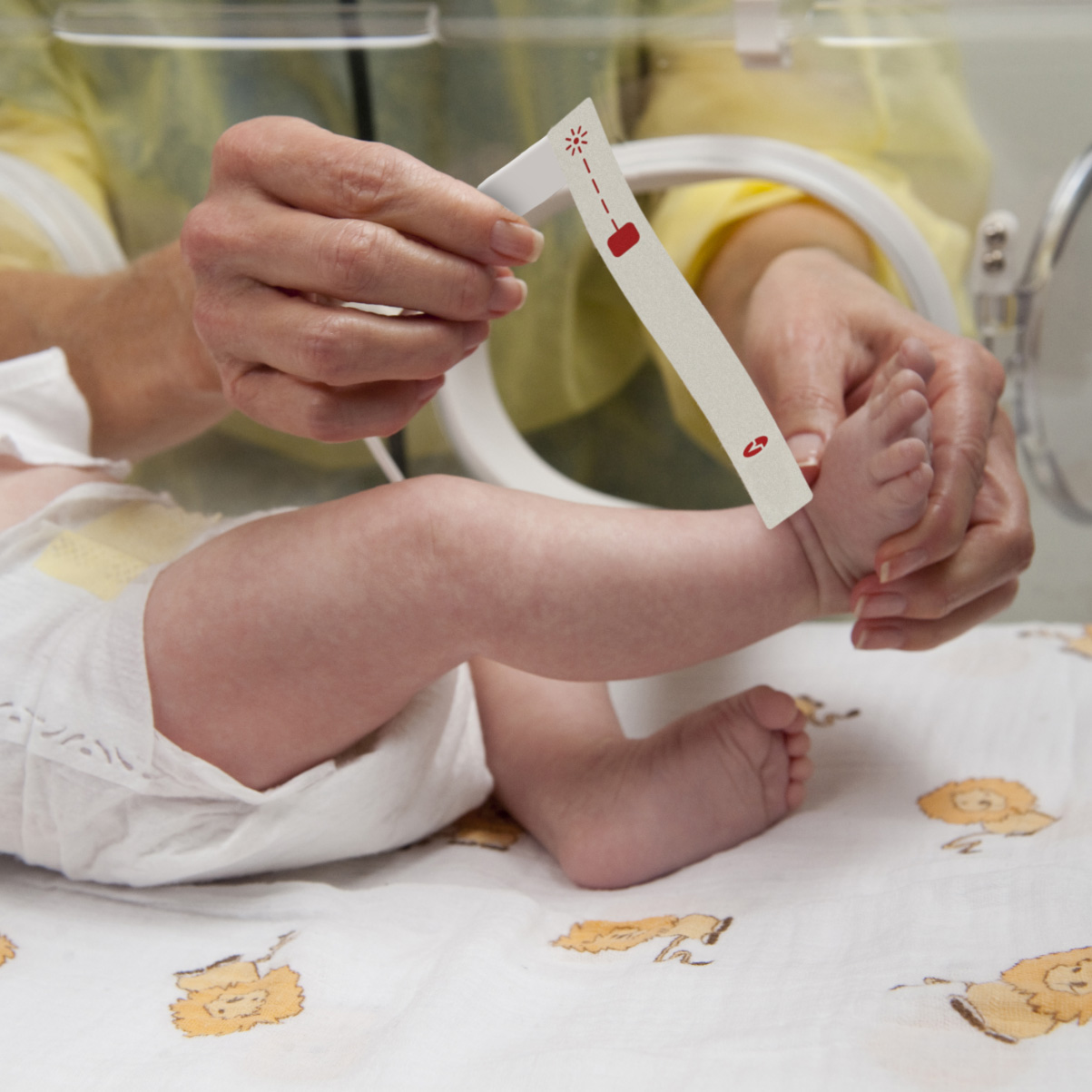 Säugling im Inkubator auf der Neugeborenen-Intensivstation eines Krankenhauses wird von einem Arzt mit einem Masimo-Pulsoximetriesensor überwacht. 